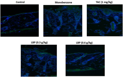 Figure 2. LBP reduced the infiltration of CD8+ T cells in skin lesions of monobenzone induced vitiligo mice. Immunofluorescence Staining for CD8 + T cells in skin sections from different groups of mice. The green fluorescence intensity represents the level of CD8 + expression, and the blue fluorescence is DAPI staining.