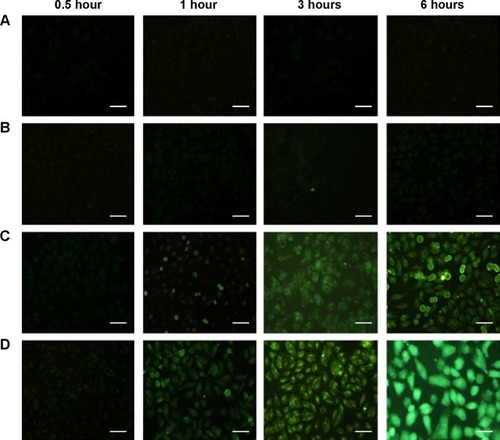 Figure 5 Uptake of SWCNTs and HA-SWCNTs in MCF-7 cell.Notes: (A) Control group; (B) FITC group; (C) SWCNTs group; (D) HA-SWCNTs group. Scale bar corresponds to 10 µm.Abbreviations: FITC, fluorescein isothiocyanate; HA-SWCNTs, hyaluronic acid-functionalized single-walled carbon nanotubes; SWCNTs, single-walled carbon nanotubes.