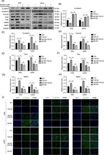 Figure 6. ML-792 rebalances EMT-related proteins in human osteosarcoma cells (HOCs) induced by TGF-β1. HOCs were treated with or without TGF-β1(10 ng/mL) in the absence or presence of ML792(1 µmol/L) for 24 h. (A-H) The expressions of invasion, migration, and EMT proteins were evaluated by Western blot. (I) Immunofluorescence was used to analyze the protein expression of Vimentin, N-cadherin, and E-cadherin in HOCs. Magnification, 200x. *P < 0.05, **P < 0.01. TGF-β1, transforming growth factor-β1.