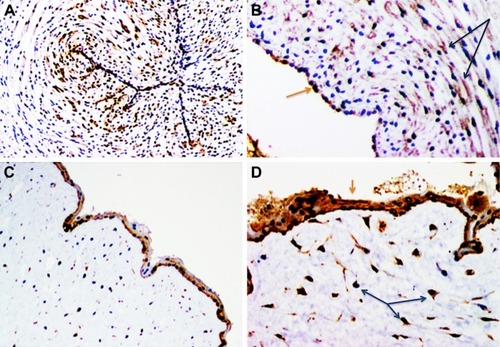 Figure 2 VEGF-A. Representative immunohistochemistry staining for VEGF-A in the umbilical cord.