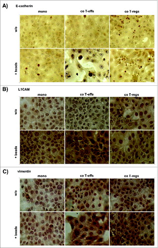 Figure 4. An altered EMT marker expression predominates in H6c7 cells when co-cultured with activated CD4+ T-effs. H6c7 cells were monocultured (mono) or directly co-cultured with T-effs (co T-effs) or T-regs (co T-regs) for 72 h, either in the absence (w/o) or presence of activation beads (+ beads). Immunocytochemistry were used to detect (A) E-cadherin, (B) L1CAM and (C) vimentin in mono- and co-cultured H6c7 cells still adherent in 96-well-plates. Representative stainings of three independent experiments with T cells isolated from three individual donors are shown at 580-fold magnification.