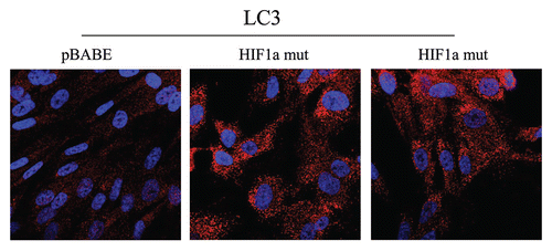 Figure 6 Localization of LC3, an autophagy marker, in activated HIF1a transfected fibroblasts. LC3 is a well-established marker of autophagosomes. Note that LC3 immunostaining yields a characteristic fluorescence pattern that is consistent with the autophagic phenotype, in fibroblasts expressing activated HIF1a.