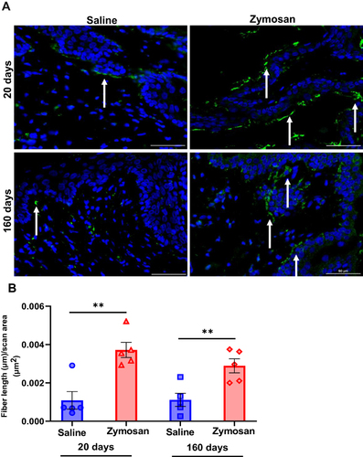 Figure 7 Hyperinnervation of vulvar nerves after multiple rounds of zymosan administration. (A) Nerve fibers [as detected by immunoreactivity (IR) for the pan-axonal marker protein gene product 9.5 (PGP 9.5; green)] merged with dapi stain (blue). Scale bar: 50 µm. (B) Fiber length (µm) per unit area (µm2) in the zymosan and saline groups after 20 and 160 days of the 3rd round of zymosan/saline administration (n=5 per group). Mean ± SEM. **P<0.005.