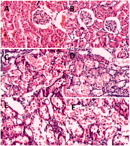 Figure 2. Histological evaluations of renal tissues. (A–F): Representative kidney sections obtained 24 h after sham surgery or I/R. (A) Section from young sham-operated rats. (B) Section from aged sham-operated rats. (C) Section from young rats subjected to I/R. (D) Section from aged rats subjected to I/R. (E) Section from young rats subjected to I/R and IPoC. (F) Section from aged rats subjected to I/R and IPoC. Note: All Hematoxylin and Eosin ×400.