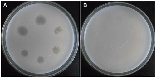 Figure 1 Sensitivity of wild-type Mycobacterium smegmatis mc2 155 and M12 to phage SWU1. (A) wild-type M. smegmatis mc2 155 strain can form obvious plaque for SWU1. (B) M12 mutant strain cannot form plaque.