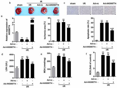 Figure 3. AK006774 inhibits the I/R-induced oxidative stress and cardiac injury in vivo. (a) qPCR was used to evaluate the efficiency of AK006774-overexpressing adenovirus. (b) TTC staining was performed to evaluate the infarct area of the heart. (c) TUNEL staining was carried out to detect the apoptosis of cardiomyocytes. (d–f) The levels of LDH, MDA, and ROS in the myocardium were detected using commercial kits. ** p < 0.01 vs Ad-nc or sham group, # p < 0.05 vs I/R+ Ad-nc