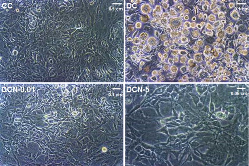 Figure 1. Effect of NAC on 3T3-L1 cells at 10 days of differentiation. Control cells (CC); MDI-treated cells (DC); MDI + 0.01 mM NAC-treated cells (DCN-0.01); MDI + 5 mM NAC-treated cells (DCN-5). Representative results from one of four independent experiments with similar results are shown.
