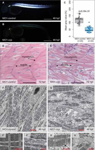 Figure 2. Vcp deficiency results in a severe skeletal muscle myopathy. (a and b) Lateral view of control (a) and vcp morphants (b) showing birefringence at 48 hpf. scale bar: 450 μm. (c) Densitometric analysis of birefringence (n = 23/25). Individual samples are shown (two-sided Wilcoxon rank-sum test). (d and e) Skeletal muscle H&E-stained sagittal histological sections of MO1-control- (d) and MO1-vcp-injected embryos (e) at 72 hpf; scale bar: 100 μm. (f to g``) Transmission electron microscopy in control embryos (f to f``) and vcp morphants (g to g``) at 48 hpf. (f to f``) MO1-control-injected embryos show organized myofibrils and sarcomeric units with highly structured thick and thin filaments (f`) and mitochondria with many cristae (f``). (g to g``) VCP-deficient muscle cells present disorganized myofibrils with Z-disc alterations (arrow, g`), dysmorphic mitochondria (g``) and an accumulation of numerous vesicular bodies (double arrowheads, g); scale bar: 2.5 μm (f, g); scale bar: 1 μm (f` and f``, g` and g``).