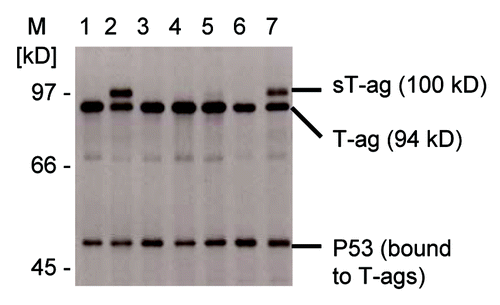 Figure 1. Detection of a 100 kD SV40 sT-ag in SV40-transfomed rat cell clones. SDS gel electrophoresis of immunoprecipitated SV40 T-ag-specific proteins from seven (lane 1 to 7) rat 2 cell lines that were transfected with SV40 DNA coding for the 94 kD T-ag. All cell clones expressed the regular 94 kD T-ag and co-immunoprecipitated T-ag-bound p53. Two highly transformed cell clones 2 and 7 strongly expressed the additional 100 kD sT-ag. A faint 100 kD sT-ag band was also detectable for the normally transformed cell clone 5.