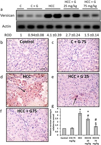 Figure 8. Effect of genistein at 25 and 75 mg/kg on hepatic versican protein expression levels in TAA-induced HCC rats. (a) Versican protein expression levels were determined via western blotting. Photomicrographs of immunohistochemically stained hepatic sections using anti-versican antibodies in the following groups: (b) Control group; (c) control group treated with genistein at 75 mg/kg; (d) HCC group; (e) HCC rats treated with 25 mg/kg genistein; and (f) HCC rats treated with 75 mg/kg genistein. (g) Relative immune-staining score of versican showing increase in HCC sections that was reduced by genistein treatment. Scale bars, 50 µm. *P < 0.05 vs. control group; #P < 0.05 vs. HCC group; and $P < 0.05 vs. HCC + 75 mg/kg genistein group. TAA, thioacetamide; HCC, hepatocellular carcinoma; C, control; G, genistein.