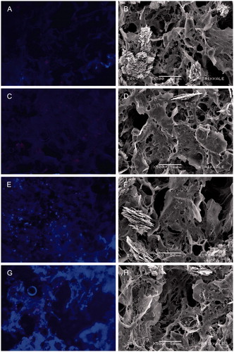 Figure 5. MC3T3-E1 mouse osteoblast cells on the scaffolds prepared by from 5% the copolymer solutions by freeze drying and salt leaching, plain and growth factor’s loaded–representative images: (A) and (B) SEM and fluorescence images of the plain scaffolds after 7 d culture, respectively; (C) and (D) SEM and fluorescence images of the plain scaffolds after 14 d; (E) and (F) SEM and fluorescence images of the scaffolds loaded with VEGF/BMP-2 after 7 d culture, respectively; and (G) and (H) SEM and fluorescence images of the scaffolds loaded with VEGF/BMP-2 after 14 d, respectively.