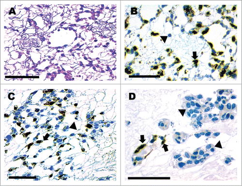 Figure 3. Three-day incubation of scaffold showing antegrade seeding of vasculature and retrograde seeding of collecting system. H&E (A). GFP+ cells line peritubular capillary vessels (B–D) while a GFP− βTC-tet cell population (D) occupy tubular structures. GFP+ cells are marked by arrows and the GFP− βTC-tet cells with arrowheads (B–D). Scale bar 100 μm.