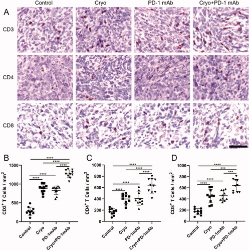 Figure 5. IHC analysis of TILs in distant tumor tissues after treatment with different methods. A, Representative immunohistochemical sections of CD3, CD4 and CD8 T cells in distant tumor tissues of each group after treatment with different methods. Bars, 50 μm. B-D, The corresponding quantification of CD3, CD4 and CD8 T cells in distant tumor tissues of each group after different treatments. Ten visual fields were randomly selected from each slide for analysis. All results are representative of three independent experiments with five mice per group.