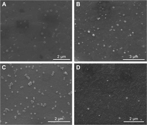 Figure 2 DODAC/PHO-S liposome characterization by SEM.Notes: Results were obtained from three independent experiments. The morphology of the DODAC/PHO-S liposomal formulation was analyzed by SEM. SEM of a 0.3 mM (A) and 2.0 mM empty DODAC (B); 0.3 mM (C) and 2.0 mM DODAC/PHO-S (D).Abbreviations: DODAC, dioctadecyldimethylammonium chloride; PHO-S, synthetic phosphoethanolamine; SEM, scanning electron microscopy.