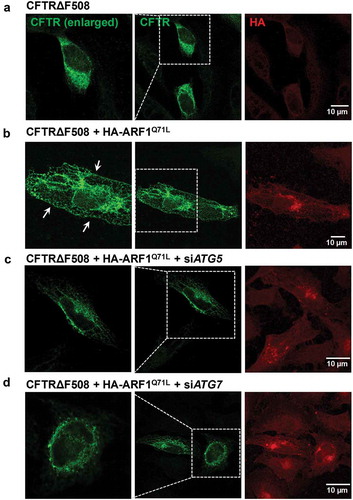 Figure 4. Immunofluorescence analysis of CFTRΔF508 in cells treated with siRNAs against ATG5 and ATG7. HEK293 cells were transfected with the indicated plasmids or siRNAs (36 h), and then immunostained with anti-CFTR (green, Alexa Flour 488) and anti-HA (red, Alexa Fluor 568) antibodies. Anti-HA immunofluorescence represents the expression levels of ARF1Q71L. Fields enclosed by boxes in CFTR images are shown at higher magnification to the left. (a) CFTRΔF508 is mostly expressed in intracellular regions. (b) Co-transfection with ARF1Q71L in HEK293 cells induced cell-surface expression of CFTRΔF508 (white arrows). (c Treatments with siRNAs against ATG5 (siATG5) and (d) treatments with siRNAs against ATG7 (siATG7) abolished the ARF1Q71L-induced cell surface expression of mutant CFTR. Four independent experiments showed similar results. Scale bar: 10 µm.