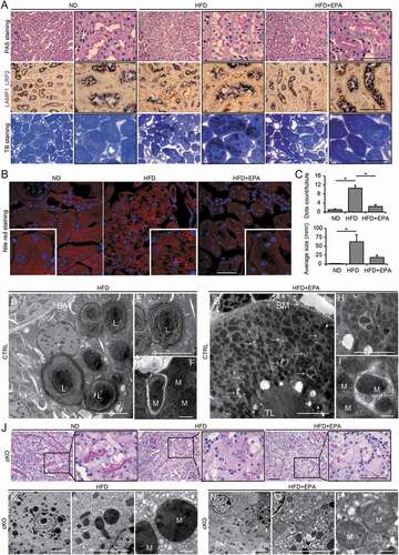 Figure 1. EPA reduces an HFD-induced phospholipid accumulation in the PTEC lysosomes. (A, B) Images of PAS staining, LAMP1 immunostaining, toluidine blue staining, and Nile red staining of the kidney cortical regions of the nonobese, obese, and EPA-supplemented obese mice (n = 6 to 7 in each group). Sections were immunostained for LRP2, a marker of proximal tubules (blue) (A, middle) and counterstained with DAPI (blue) (B). (C) The number (per proximal tubule) and the sizes (per area [mm2]) of Nile red-positive puncta under each condition was counted in at least 10 high-power fields (× 600) (each high-power field contains 10 to15 proximal tubules) (n = 3 in each group). (D-I, K-P) Electron micrographs of the kidneys of the obese and the EPA-supplemented obese Atg5 F/F-CTRL (D-I) and atg5-cKO mice (K-P) (n = 3 in each group). (J) Images of PAS-stained kidney cortical regions of the nonobese, obese, and EPA-supplemented obese atg5-cKO mice (n = 6 to 7 in each group). Bars: 50 μm (A, B, J), 5 μm (D, E, G, H, K, L, N, O), and 500 nm (F, I, M, P). Values represent means ± SE. Statistically significant differences (*P < 0.05) are indicated. All images are representative of multiple experiments. BM, basement membrane; L, lysosomes; TL, tubular lumen; M, mitochondria; arrows, autophagosomes, *, nucleus. Magnified images of lysosomes or mitochondria are presented. CTRL: Atg5 F/F-CTRL mice; cKO: atg5-cKO mice