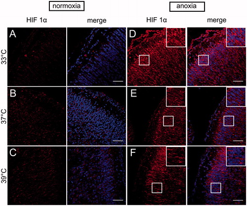 Figure 4. HIF-1α immunolocalization in the neocortex of neonatal rats brain at different body temperatures (33 , 37 and 39 °C) 2 h after exposure to normoxic (A–C) or anoxic (D–F) conditions. Representative images show the HIF-1α immunoreactive cells (red) Co-staining for HIF-1α with Hoechst (merge) demonstrates anoxia-induced accumulation of HIF-1α in neocortex. Scale bars – 50 µm.