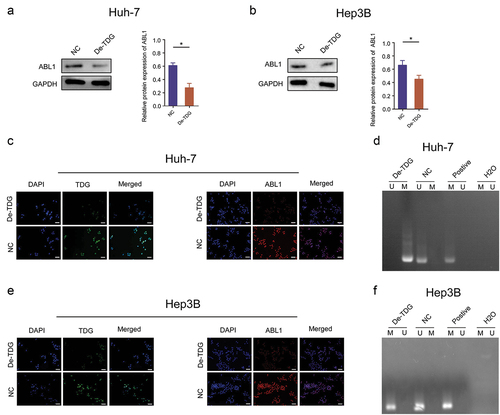 Figure 6. TDG regulates ABL1 expression through DNA methylation. (a) ABL1 protein expression after TDG expression was decreased in Huh-7 cells. (b) ABL1 protein expression after TDG expression was decreased in Hep3B cells. (c) TDG and ABL1 protein expression was detected by immunofluorescence after TDG expression was decreased in Huh-7 cells. Scale bars, 50 µm. (d) the methylation status of ABL1 after TDG expression was decreased in Huh-7 cells. (e) TDG and ABL1 protein expression was detected by immunofluorescence after TDG expression was decreased in Hep3B cells. Scale bars, 50 µm. (f) the methylation status of ABL1 after TDG expression was decreased in Hep3B cell. *P<.05.