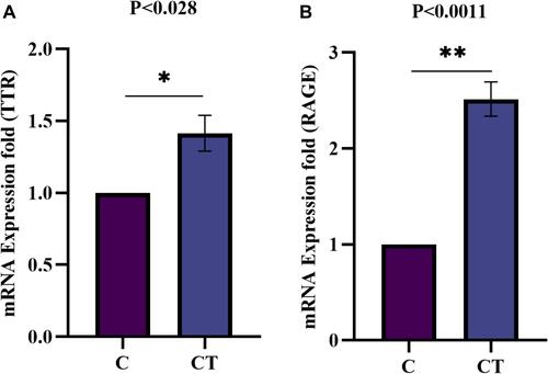 Figure 10 Fold induction of TTR and RAGE mRNA expression analysis in synovial cells by qRT-PCR. The mRNA expression in SW982 cells induced with TNF-α (10ng/mL) for 1hr, compared to control un-induced (A) Fold induction of TTR gene expression significantly (p<0.028) increased upon TNF-α induction compare to control. (B). Similarly, fold induction of RAGE gene expression indicates a significant (p<0.0011) increased level in TNF-α induced synoviocytes. The data normalized with GAPDH as an internal loading control and the values presented the mean ± SEM (n = 3). The significance level indicates *p < 0.05; **< 0.01 versus normal control and TNF-α treatment analysed by Student’s t-test.