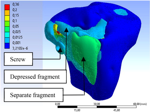 Figure 3. Simulation results : deformation filed (mm) of the model.