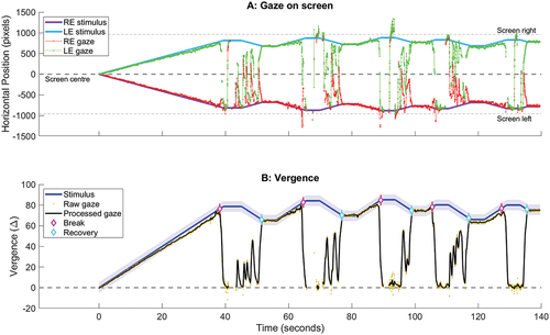 Figure 2. Eye tracking data from author TYG, for measuring convergence with stimuli moving at 2 Δ/s. A: Horizontal on-screen position of stimuli (purple/blue) and estimated gaze point (red/green) over time. B: Target separation (blue line), target diameter (blue shading), and smoothed gaze vergence (black). The magenta and cyan diamonds indicate break and recovery points identified by automated analyses.