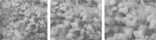 Figure 1 Figure showing the SEM images of DNPs.Abbreviations: SEM, scanning electron microscopy; DNPs, doped nanoparticles.