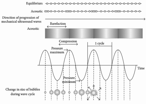 Figure 2. Ultrasound Cavitation.[Citation7].