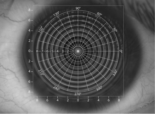 Figure 2 Overlay grid used by the Oculus NIK-BUT software.