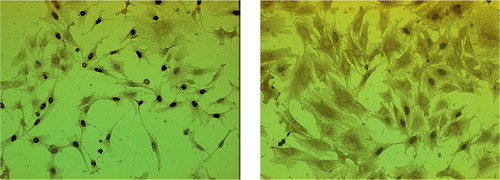 Figure 6. Cell proliferation assay (BrdU).Fibrous layer cells (A:200 ×) and cambium layer cells (B: 400 ×).
