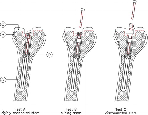 Figure 3.  Schematic representation of tests A, B, and C. The distal femur is marked as “A”, the impacted bone graft as “B”, the femoral component as “C”, and the sliding stem connection as “D”. During test A, the femoral component was extended with a rigidly connected stem. Before test B, the inner screw was removed to initiate the sliding stem mechanism. To disconnect the stem from the femoral component, the hexagonal screw was removed before test C.