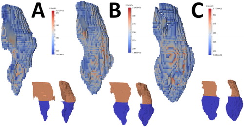 Figure 1. Anatomical segmentation example at different timing of the cycle.