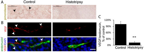 Figure 3. Histotripsy reduces hypoxia and VEGF in NGP xenografts 24 h post-treatment. A) Control tumors display regions that stain for the hypoxia marker pimonidazole (dark brown, arrowheads, bar = 1mm), while histotripsy resulted in its absence. B) VEGF expression is upregulated by hypoxia; representative images of control tumors with high VEGF (red, arrowheads) adjacent to endomucin-positive endothelial cells (green), while VEGF was reduced in histrotripsy-treated tumors (bar = 10µm). C) VEGF levels were signifcantly lower in histrotripsy-treated tumors compared to controls (p < 0.001, n = 4), confirming decreased hypoxia. Graphs represent means and standard deviation. **=p < 0.01.