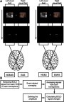 Figure S1 (A) Demonstration of the setting of conditions. (B) The procedure of fMRI data analysis after preprocessing the functional images.Abbreviations: E&S, contralateral to emotional picture & spatial cue; E&NS, contralateral to emotional picture & no spatial cue; NE&S, contralateral to neutral picture & spatial cue; NE&NS, contralateral to neutral picture & no spatial cue.