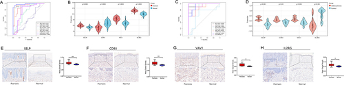 Figure 4 Identify and validate diagnostic efficacy and expression in psoriasis of diagnostic biomarkers. (A and C) ROC analysis of PA-IRGs in validation sets GSE14905 and GSE57691. The greater the AUC, the higher the diagnostic value. (B and D) The expression level of diagnostic biomarkers in GSE14905 and GSE57691. P-value < 0.05 was considered statistically significant. (E–H) IHC staining (x200) and histogram of mean optical density of diagnostic biomarkers in psoriatic lesions and healthy skin tissue. * p < 0.05, **P<0.01, the difference was statistically significant.