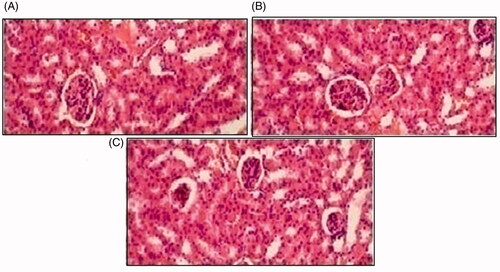 Figure 13. Histological slides of kidney of rabbit of control group I (A), after oral solution of 5-FU-MMWCH-NPs treated group II (B) and 5-FU-MMWCH-NPs treated group III (C).