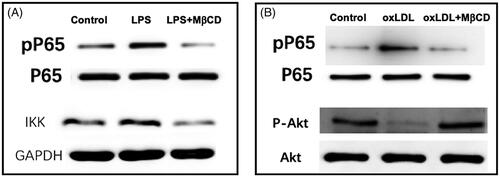 Figure 5. MβCD reverses the LPS- or oxLDL-induced changes in the contents of signal pathway key molecules in HUVECs detected by western blotting. (A) Western blots of P65 (a subunit of NF-κB), phosphorylated P65 (pP65), and IKK, respectively. Three groups are categorized: HUVECs without treatment (control), treated with LPS only (at 1 µg/mL at 37 °C for 12 h), and with both LPS and MβCD, respectively. (B) Western blots of P65, pP65, Akt, and phosphorylated Akt (p-AKT), respectively. Three groups are categorized: control, oxLDL only (at 50 µg/mL at 37 °C for 12 h), and oxLDL + MβCD, respectively.