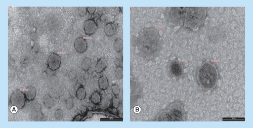 Figure 1.  Transmission electron micrographs of liposomal dispersions.(A) Conventional and (B) PEGylated liposomes loaded with opiorphin.