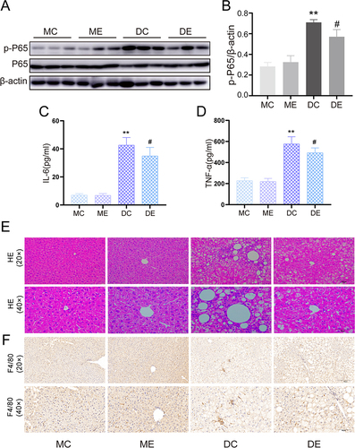 Figure 5 Aerobic exercise improves liver inflammation in db/db mic. (A) Representative Western blotting results of NF-κB P65 expression in the livers from mice in the MC, ME, DC, and DE groups. (B) Quantification of NF-κB P65 protein expression normalized to β-actin. (C) Serum IL-6 levels. (D) Serum TNF-α levels. (E) Representative images of HE staining in the liver. Scale bar: 100 μm (upper panels) and 50 μm (bottom panels). (F) Representative images of immunohistochemical staining for F4/80 in the liver. Scale bar: 100 μm (upper panels) and 50 μm (bottom panels). The mean ± SD is shown in the graph for each group, n=10. Values are statistically significant at **p < 0.01 versus the MC group, #p < 0.05 versus the DC group. MC: sedentary m/m mouse group, ME: m/m mice with aerobic exercise training group, DC: sedentary db/db mouse group, DE: db/db mice with aerobic exercise training group.