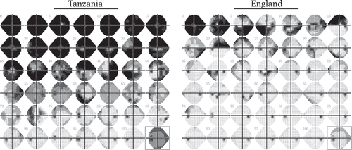 Figure 2. VF data for a representative sample of individuals (worse eye only). In both datasets, 41 individuals were sampled uniformly from 0th, 2.5th, 5th, …, 100th percentile of VF loss severity (MD). The bottom right panel (grey square) shows the average field of all patients at their first appointment (worse eye only; all eyes converted to left-eye format before mean-averaging values, pointwise, across all individuals). Note the greater number of individuals presenting with severe VF loss in Tanzania, but also that some eyes in the England cohort exhibited substantial VF loss.