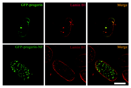 Figure 4. Expression of non-farnesylated progerin does not significantly alter the nuclear distribution of lamin B1 in transiently transfected MEFs. Confocal fluorescence micrographs showing localizations of GFP-progerin and GFP-progerin-NF (green signals) and immunofluorescence labeling with anti-lamin B1 antibodies (red signals) in the same cells; merged images are shown at the right with signal overlap appearing yellow (merge). Bar: 5 µm.