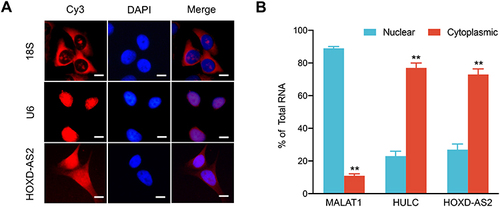 Figure 3 Subcellular localization of HOXD-AS2 in Bel-7402 cells. (A) RNA fluorescence in situ hybridization (RNA-FISH) was performed to detect subcellular location of HOXD-AS2 expression in Bel-7402 cells, U6 and 18S was positive control for nuclear and cytoplasmic localization, respectively. (B) The abundance of HOXD-AS2 in nuclear and cytoplasmic fractions of Bel-7402 cells was evaluated by qRT-PCR, MALAT1 and HULC was positive control for nuclear and cytoplasmic lncRNA, respectively. Scale bar=20 μm. Data are given as mean ± SD (n = 3). **p < 0.01.