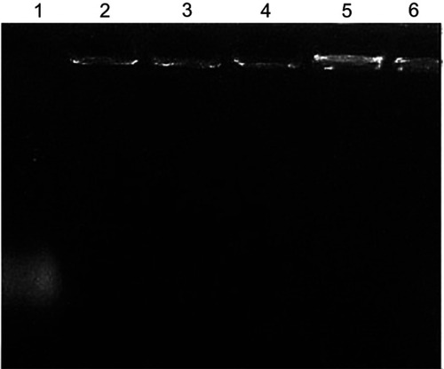 Figure 2 Electrophoretic analysis of the free pDNA and pDNA loaded chitosan-sodium deoxycholate (CS-DS) nanoparticles, lane1: free pDNA, lane 2–6: pDNA-loaded CS-DS nanoparticles (F6–F10, respectively).