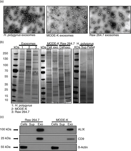 Fig. 1.  Size, shape and protein profile of exosomes derived from the nematode compared with murine cell lines. (a) TEM images of exosomes from H. polygyrus (left panel), MODE-K cells (middle panel) and Raw 264.7 cells (right panel). Scale bar is 200 nm. (b) Protein profiles assessed by silver stain analysis of nematode exosomes compared with mammalian exosomes (left panel), mammalian exosomes compared with producing cell lysates (middle panel), and supernatant and pellet fractions following ultracentrifugation of H. polygyrus secretion product (right panel). (c) Western blot analysis of exosome-associated markers in the mouse ultracentrifugation products (supernatants and pellets) compared with the whole cell lysates. A total of 2 µg protein was loaded on each gel for silver stain analysis and 3 µg for western blot analysis. Arrows indicate closest ladder band with noted molecular weight.