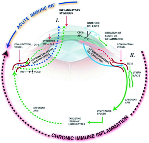 FIGURE 2.  Inflammatory circle of chronic dry eye. Stress to the ocular surface triggers the initial events leading to localized autoimmunity. Acute response cytokines, such as TNF-α, IL-1α, IL-1β, and IL-6 further enhance proinflammatory cytokine/chemokine production, adhesion molecule expression required for innate cell infiltration, and also activate resident antigen presenting cells (APCs). Mature APCs home to the regional lymph nodes to activate Th1 and Th17 cells. Autoreactive T cells traffic to the ocular surface tissues where they potentiate the chronic autoimmune response and cause pathology. For example, IFN-γ alters mucins on corneal epithelial cells and is linked to epithelial cell apoptosis, goblet cell loss, and squamous metaplasia. IL-17 increases MMP3/9 expression and induces corneal epithelial barrier dysfunction. In addition, recent data suggest that autoantibodies bind to antigens expressed in the LFU to cause complement-dependent tissue destruction.