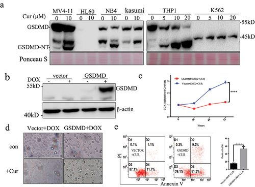 Figure 4. Overexpression of GSDMD enhance anti-leukemia effect of curcumin.