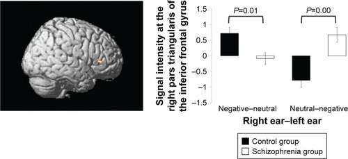 Figure 3 Functional magnetic resonance imaging results.