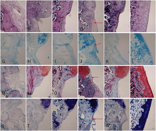 Figure 8. Immunohistochemistry of the cartilage. (A–F) HE staining of the cartilage in repaired groups A–E and sham group, respectively; (G–L) Alcian blue staining of the cartilage in repaired group A–E and sham group respectively; (M–R) Safranin O staining of the cartilage in repaired groups A–E and sham group, respectively; (S–X) Toluidine blue staining of the cartilage in repaired groups A–E and sham group, respectively. Scale bar =100 μm.