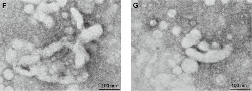 Figure 4 (A) TEM of CsA-loaded mPEG-PLA micelles and the appearance of the ophthalmic solution. (B) Representative size distribution of CsA-loaded mPEG-PLA micelles and (C) its zeta potential analysis. (D) The stability of micelles with different pH and temperature. TEM of CsA-loaded mPEG-PLA micelles after 10 days stored at (E) 40°C, (F) 60°C, and (G) 4,500±500 Lx light, respectively. n=3, mean ± SD. *, **, and *** represent P<0.05, P<0.01, and P<0.001, respectively.Abbreviations: CsA, cyclosporine-A; mPEG, methoxy poly(ethylene glycol); PLA, poly(lactide); TEM, transmission electron micrograph.