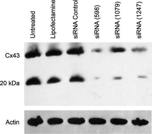 Figure 3 siRNA silencing of Cx43 proteins reduces the production of both the full-length and 20-kDa fragment of Cx43. Western blot analysis was performed for Cx43 in bEnd3 cells treated with either lipofectamine alone, lipofectamine with a control siRNA construct or with three different Cx43-specific siRNA constructs (identified as 598, 1079 and 1247, based on their position in the cDNA relative to the 5′ end). Notice that the decrease in the density of the 20-kDa band paralleled the change in the density of the 43-kDa protein, thus suggesting that both proteins are the product of expression of the Cx43 gene. After probing for Cx43 the blot was stripped with SDS and 2-mercaptoethanol and reprobed for actin.