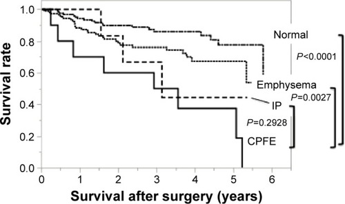 Figure 1 Overall survival in the four groups: Kaplan–Meier curves for OS after surgery.